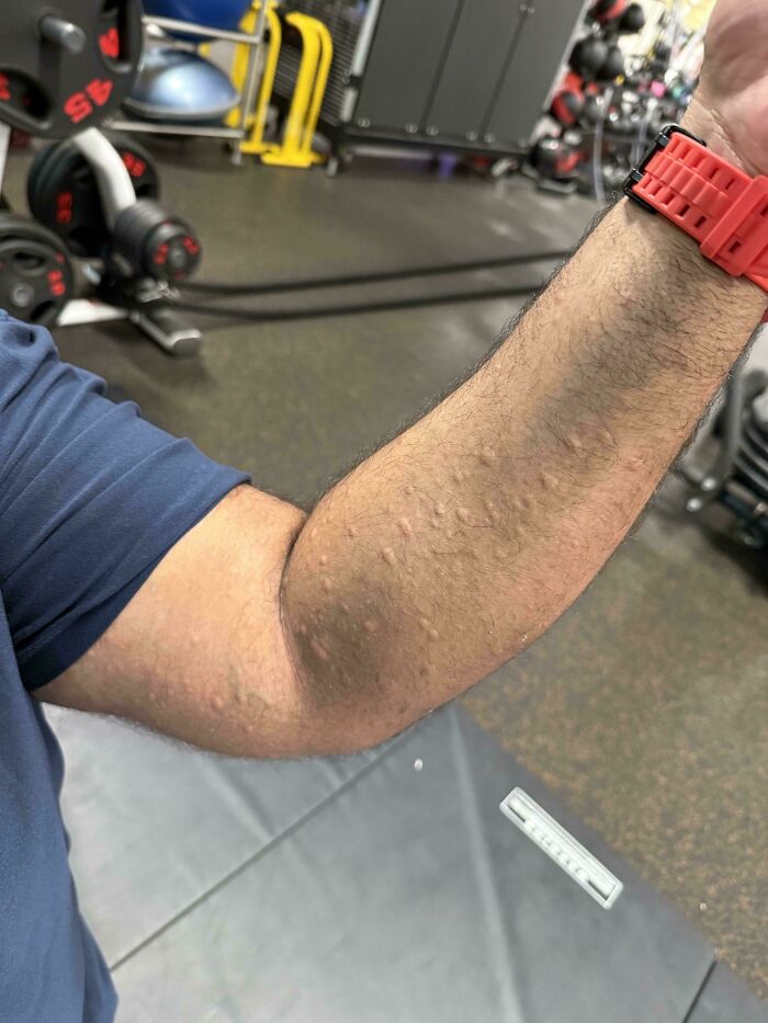 A person's forearm with numerous small bumps, showcasing an unexpected body quirk or reaction.