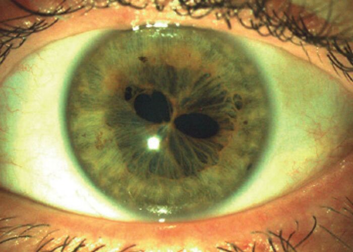 A macro shot of an eye with a four-leaf clover shaped pupil, a rare and fascinating body quirk.