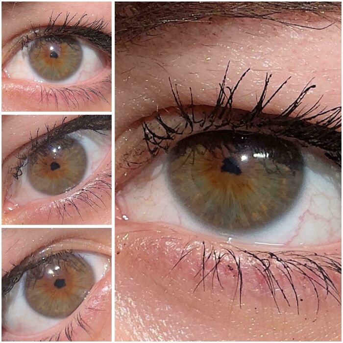 A close-up collage of an eye with a dark, triangular pupil, highlighting unique body quirks.