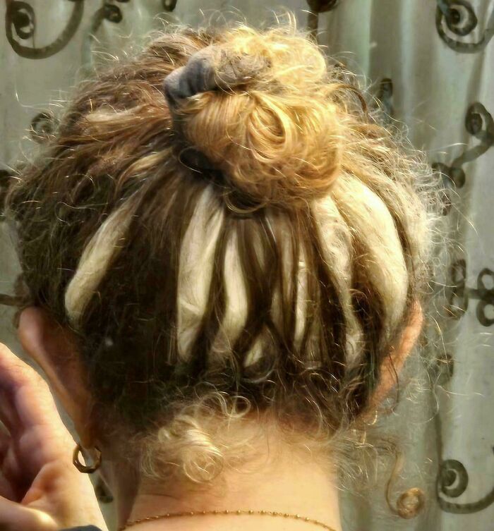The back of a head with hair showing a distinctive two-toned pattern, a unique body quirk.