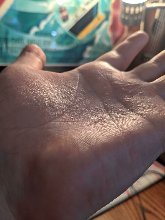 A close-up of a human palm, displaying a tiny, almost invisible splinter, caused by mischievous kids.