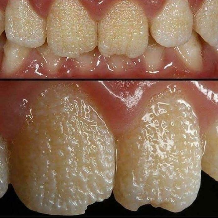 A close-up of teeth with a unique texture, showcasing a fascinating body quirk.