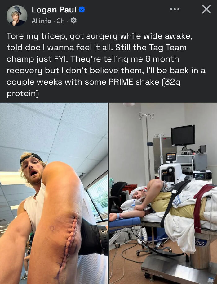 A split image of Logan Paul showing a tricep surgery scar and lying in a hospital bed, an embarrassing lie.