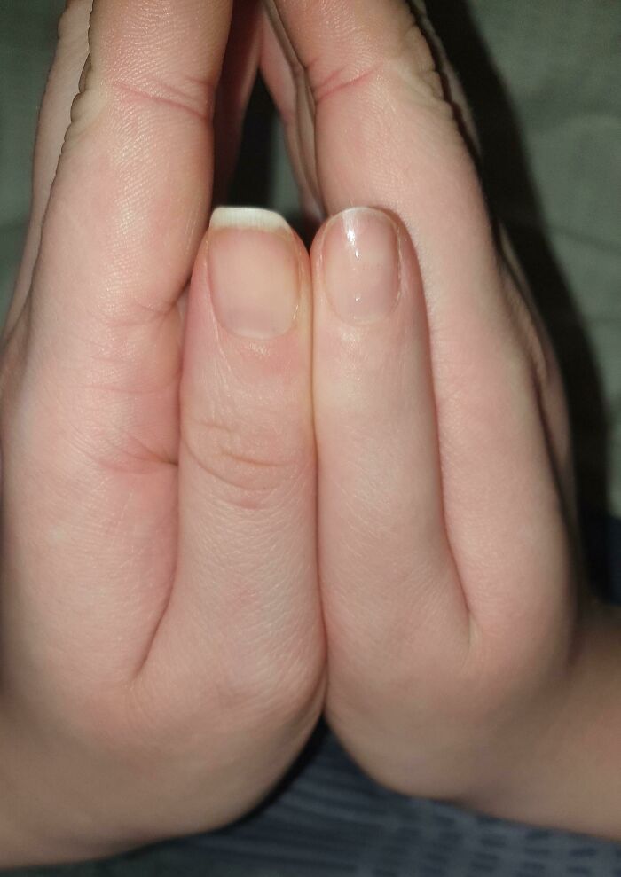 Two hands pressed together showing rare fingernail and finger alignment