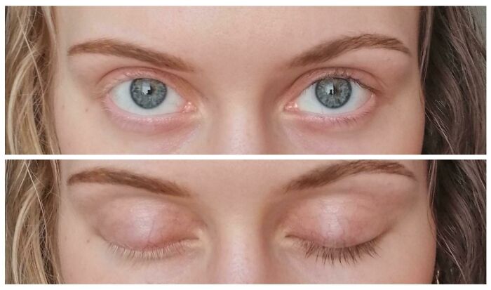 Close-up of strikingly rare blue eyes with open and closed eyelids