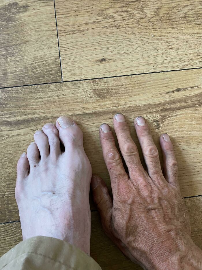 Rare physical features with mismatched foot and hand on wooden floor