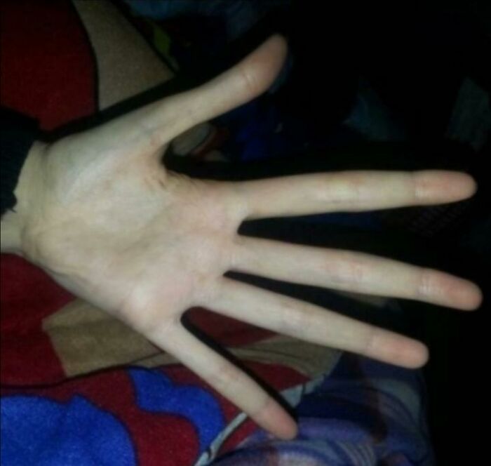 Hand with exceptionally long fingers demonstrating rare physical feature