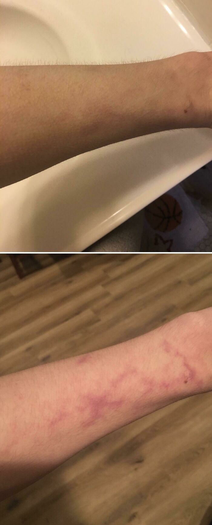 Distinctive rare skin patterns on forearms with visible unusual markings