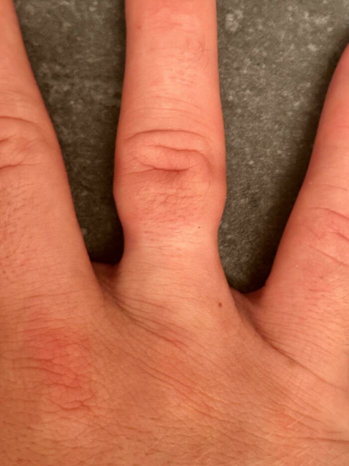Close-up of hand with rare double jointed finger bending backward