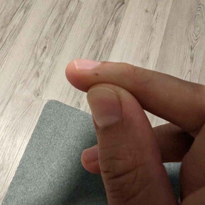 Closeup of finger with extremely rare small nub feature