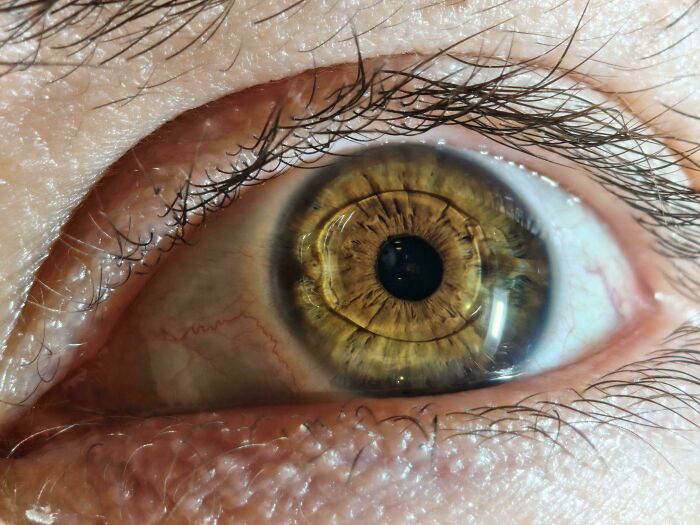 Close up of rare human eye with unique physical features
