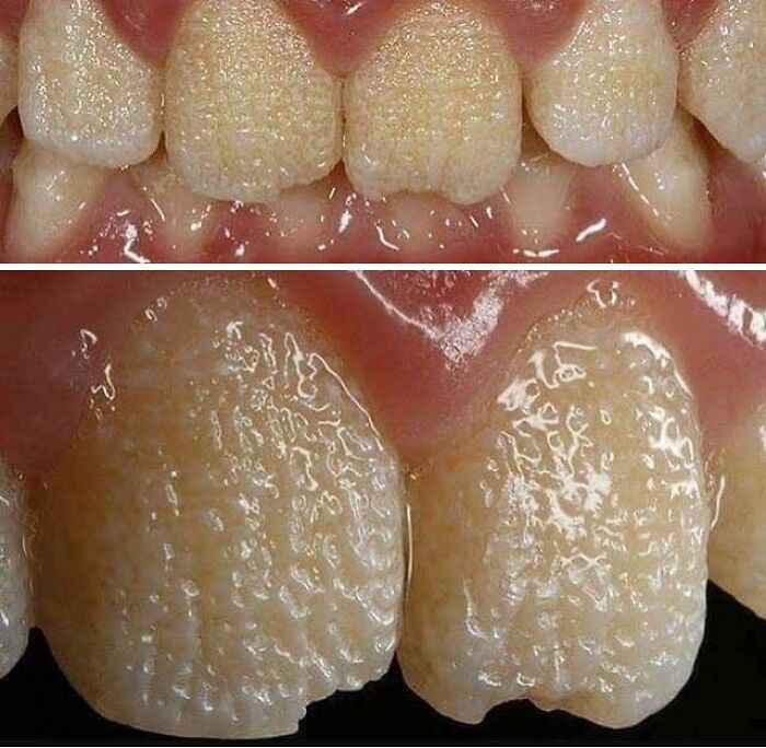 Close-up of rare textured teeth surface with unique patterns