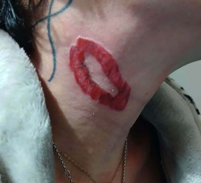 Bad Tatto From A Guy In My Town (Just Scratching The Surface)