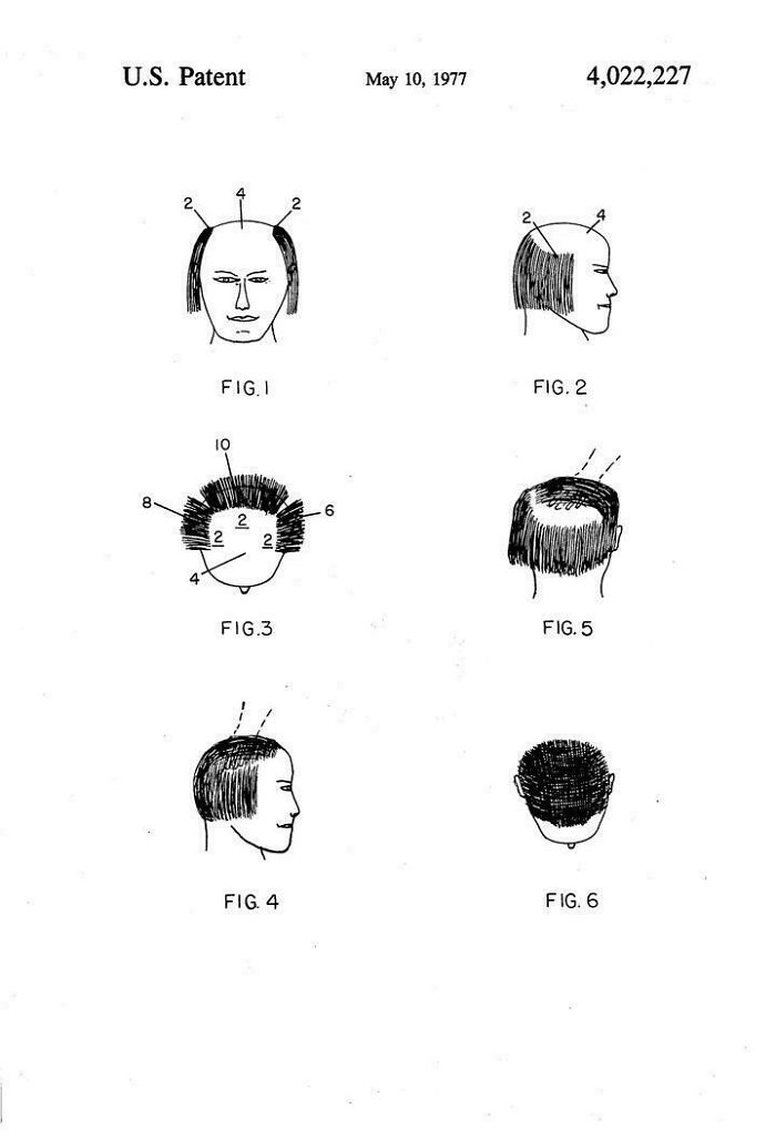 1977 patent drawings illustrating male hair patterns and styles