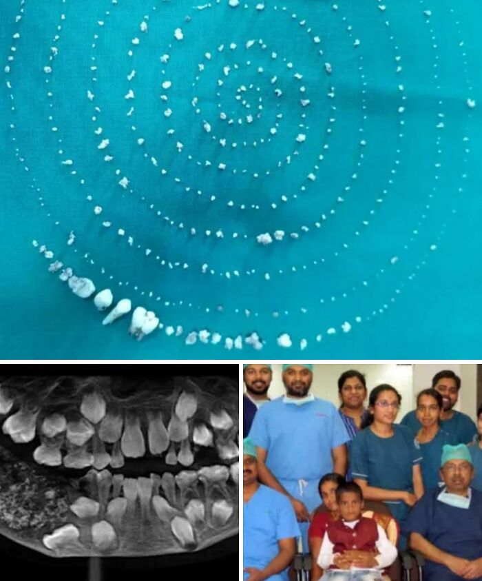 Spiral pattern of human teeth arranged on a blue surface morbid curiosity
