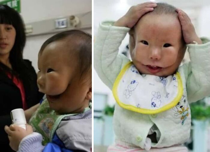 Baby with rare physical features and unique facial structure