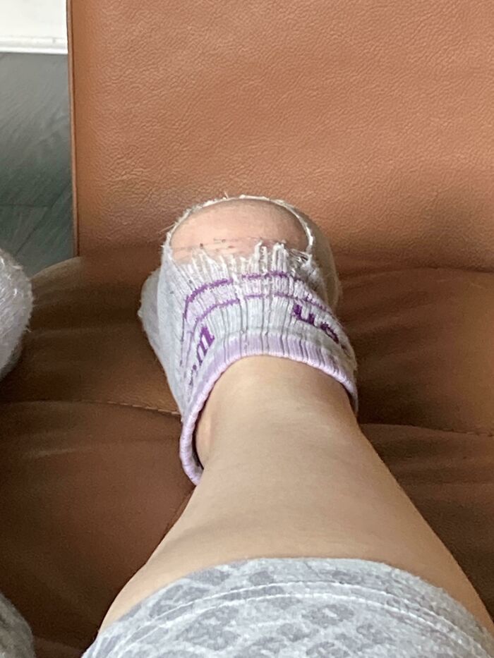 A worn-out grey sock with a large hole revealing the wearer's heel