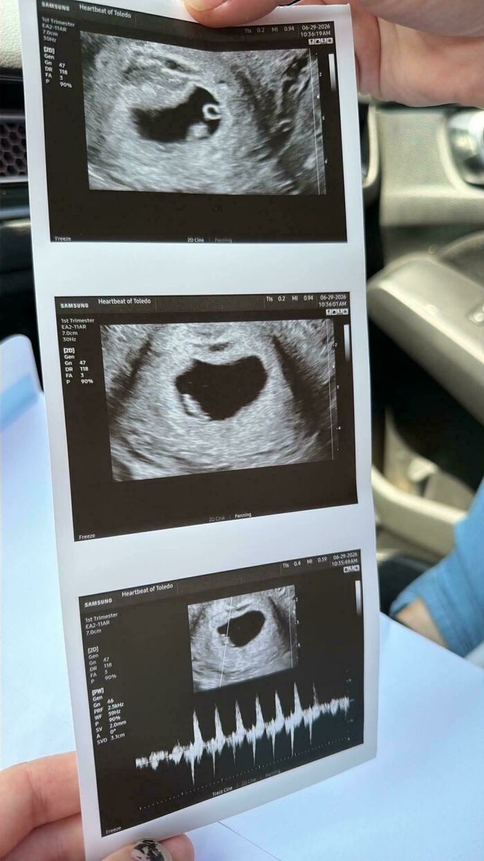 Ultrasound scan images showing a developing baby, representing wholesome pics of dads celebrating fatherhood