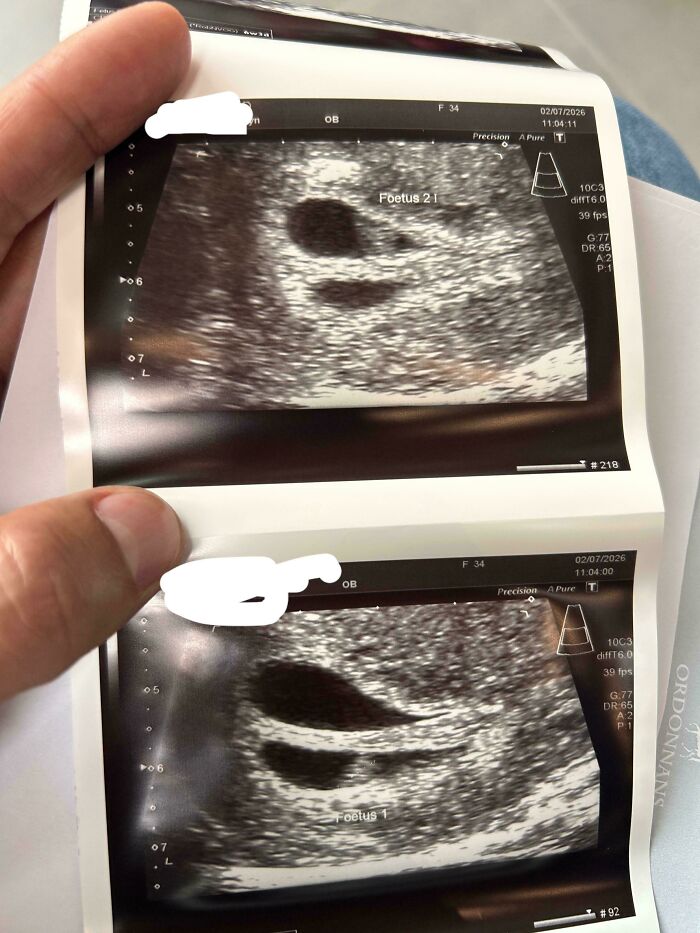 A person holding ultrasound images of twins, part of wholesome pics of dads preparing for parenthood.