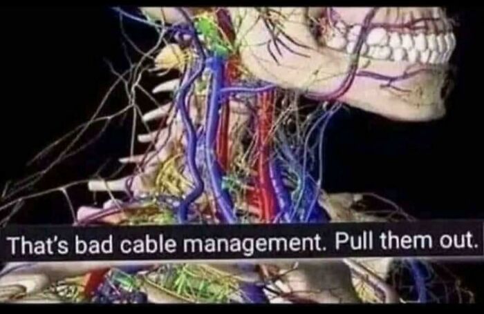 Funny memes depicting a medical anatomical model of neck nerves captioned as bad cable management.