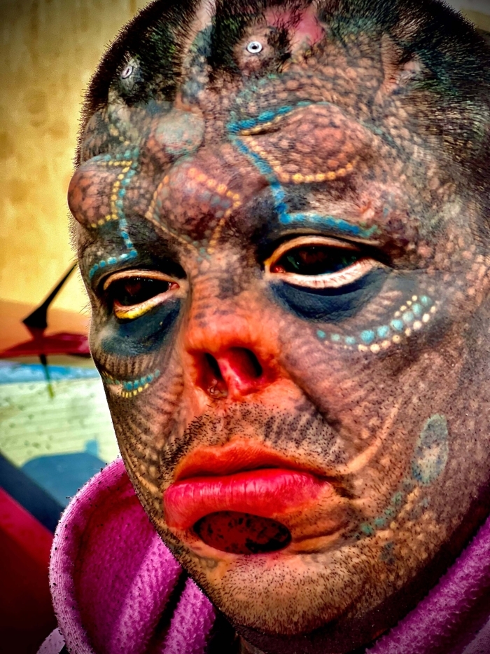 Man Undergoes Extreme Body Modifications—Including Cutting His Fingers And Nose—To Become “The Amphibian Man” Man Undergoes Extreme Body Modifications—Including Cutting His Fingers And Nose—To Become “The Amphibian Man”