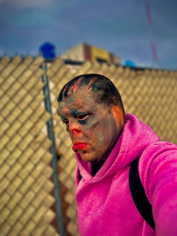 Man Undergoes Extreme Body Modifications—Including Cutting His Fingers And Nose—To Become “The Amphibian Man” Man Undergoes Extreme Body Modifications—Including Cutting His Fingers And Nose—To Become “The Amphibian Man”
