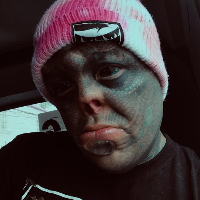 Man Undergoes Extreme Body Modifications—Including Cutting His Fingers And Nose—To Become “The Amphibian Man” Man Undergoes Extreme Body Modifications—Including Cutting His Fingers And Nose—To Become “The Amphibian Man”