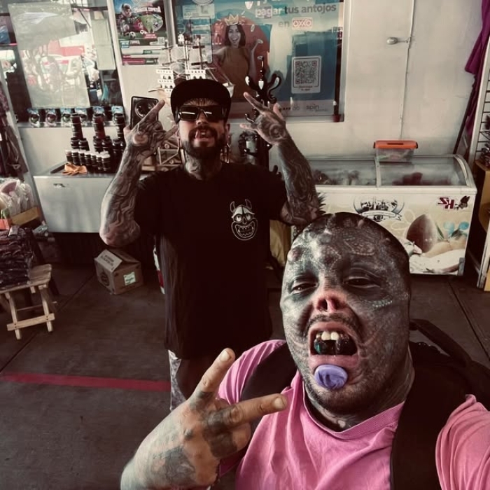 Man Undergoes Extreme Body Modifications—Including Cutting His Fingers And Nose—To Become “The Amphibian Man” Man Undergoes Extreme Body Modifications—Including Cutting His Fingers And Nose—To Become “The Amphibian Man”