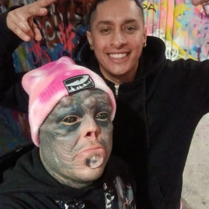 Man Undergoes Extreme Body Modifications—Including Cutting His Fingers And Nose—To Become “The Amphibian Man” Man Undergoes Extreme Body Modifications—Including Cutting His Fingers And Nose—To Become “The Amphibian Man”