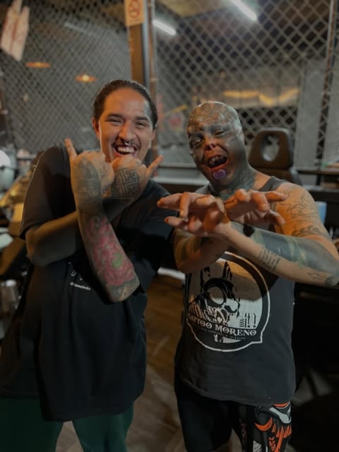 Man Undergoes Extreme Body Modifications—Including Cutting His Fingers And Nose—To Become “The Amphibian Man” Man Undergoes Extreme Body Modifications—Including Cutting His Fingers And Nose—To Become “The Amphibian Man”