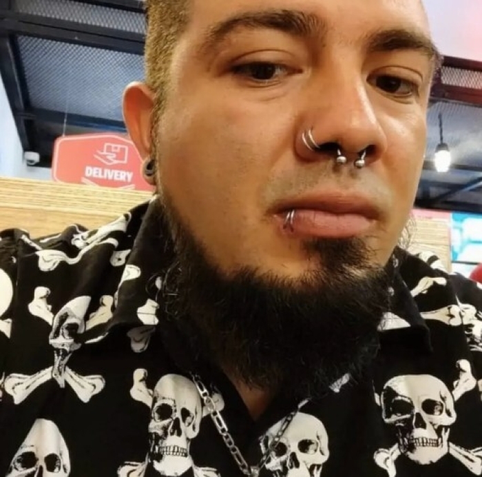Man Undergoes Extreme Body Modifications—Including Cutting His Fingers And Nose—To Become “The Amphibian Man” Man Undergoes Extreme Body Modifications—Including Cutting His Fingers And Nose—To Become “The Amphibian Man”