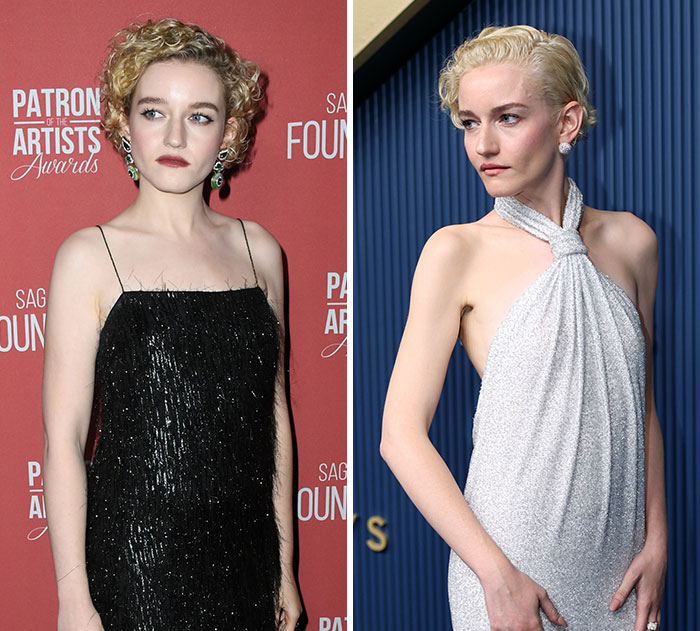 Julia Garner's plastic surgery and weight loss journey, with notable transformations for her 2026 Emmys appearance.