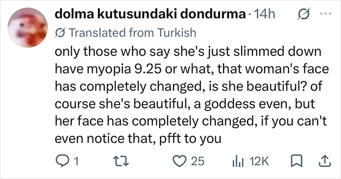 Comment on social media debating a supermodel transformation and facial changes.
