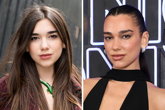 Dua Lipa's stunning looksmaxxing evolution over time, as plastic surgeons hint at subtle enhancements.