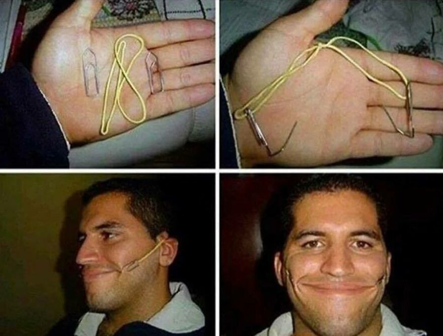 Disturbing pics of a man using paper clips and a rubber band to stretch his mouth into a chaotic smile.