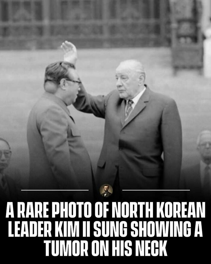 Kim Il Sung with visible tumor on his neck. Rare historical photos from history.