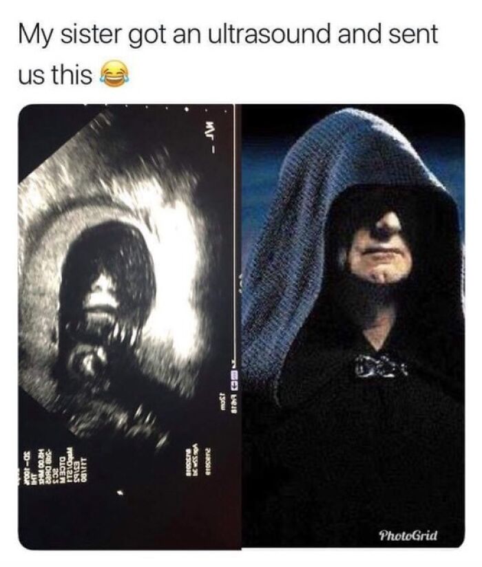 An ultrasound image next to Emperor Palpatine representing funny nostalgic pics and pop culture