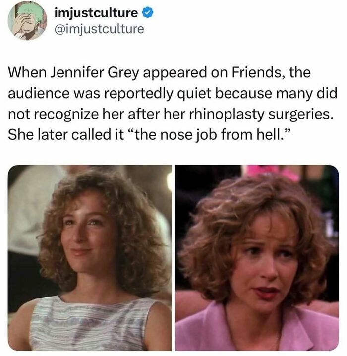 Two side-by-side images of Jennifer Grey before and after her rhinoplasty surgeries, highlighting the change in her appearance. Imjustculture posts.