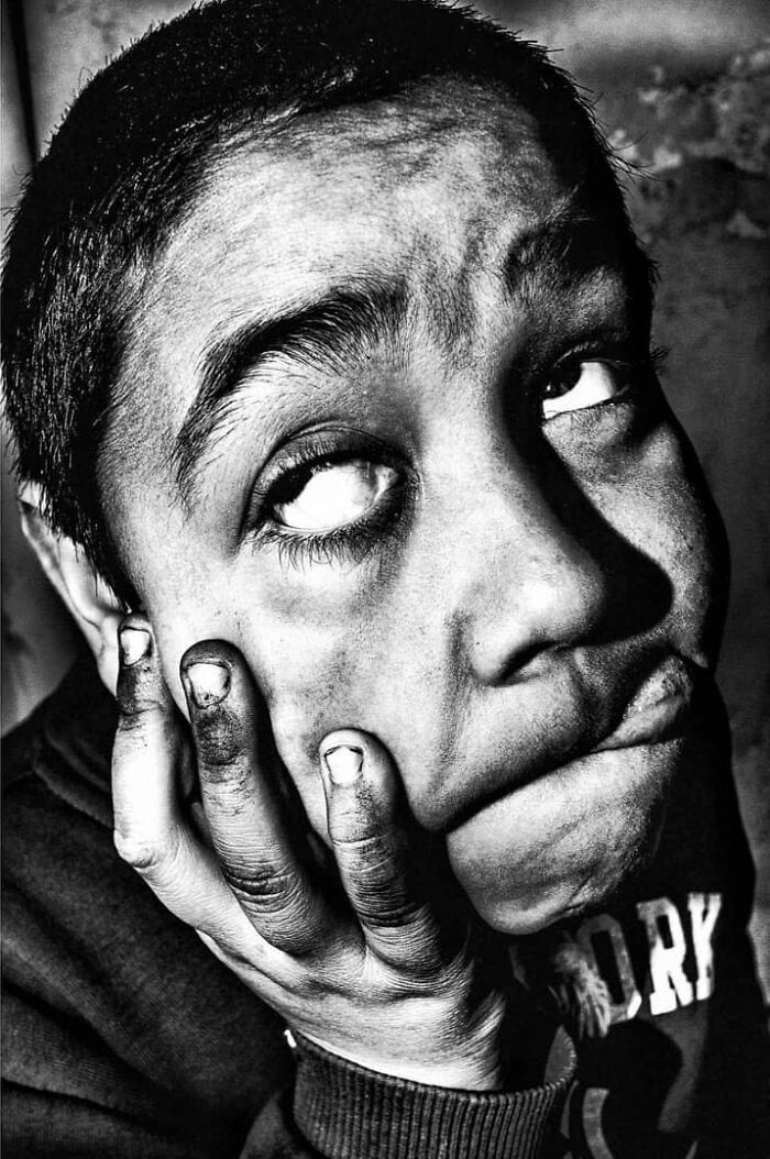A close-up, black and white street photo of a young boy making a funny face, capturing the curiosity and intensity of childhood.