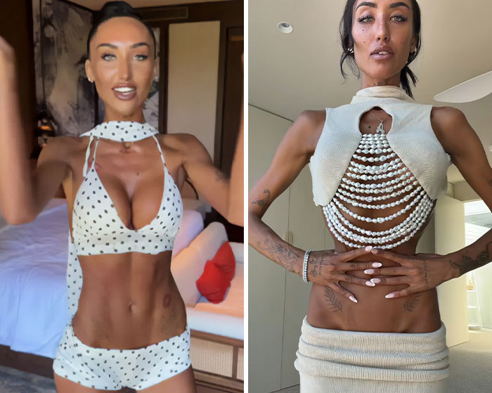 An influencer showing her extremely thin waist before and after plastic surgery An influencer showing her extremely thin waist before and after plastic surgery
