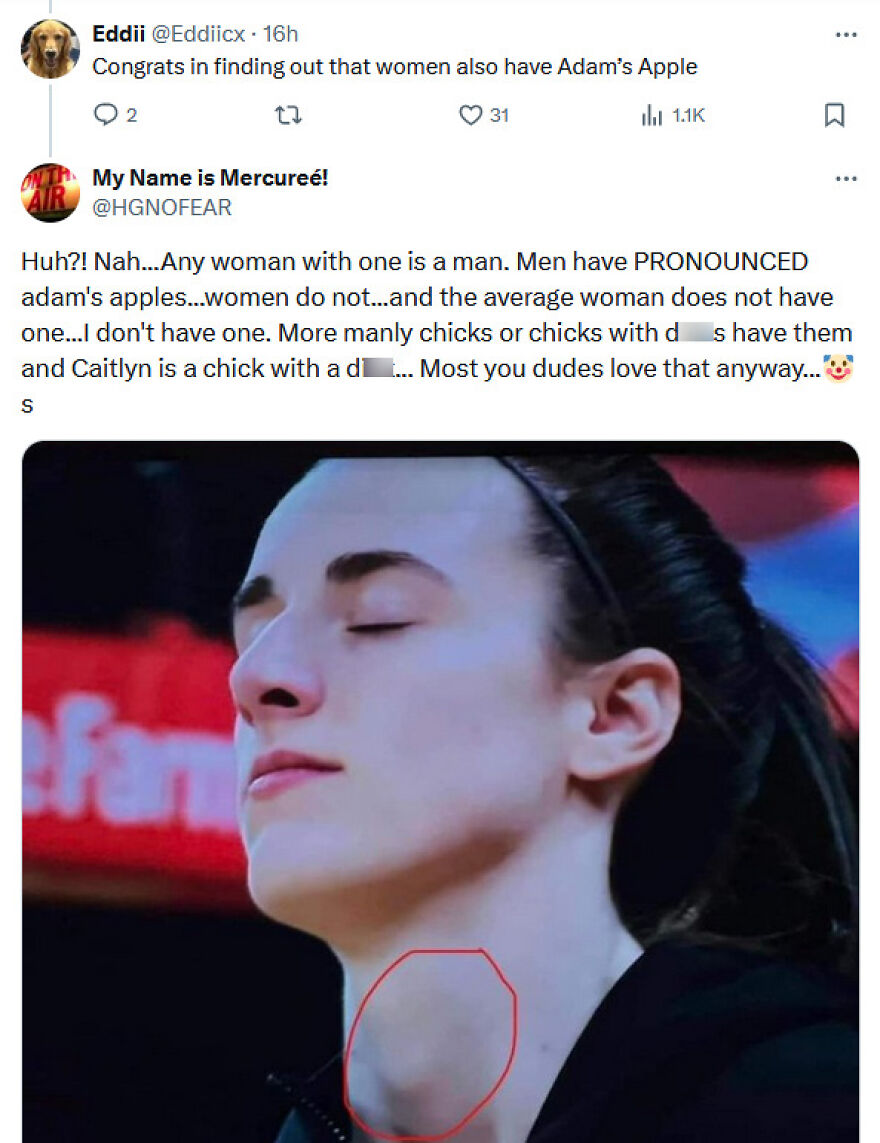A social media post with a photo of a woman's throat, highlighted, discussing Adam's apple and terrible medical takes.