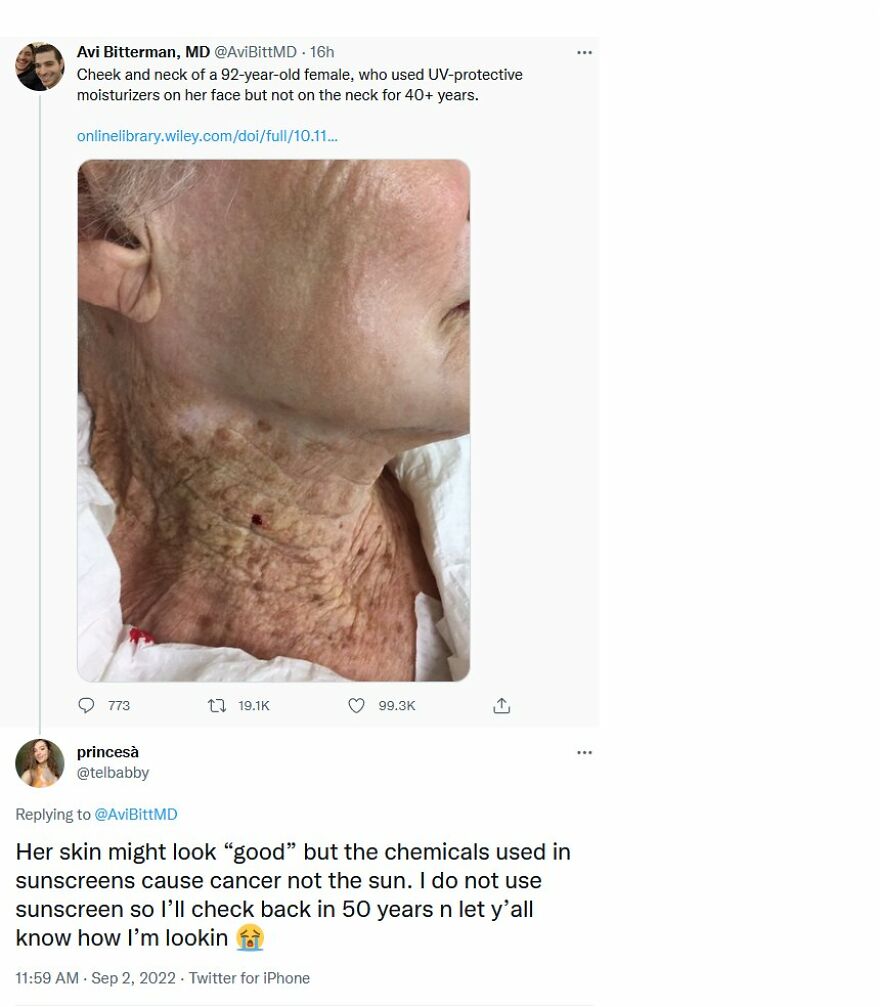 A terrible medical take tweet with an image of a woman's sun-damaged neck contrasting with her face.
