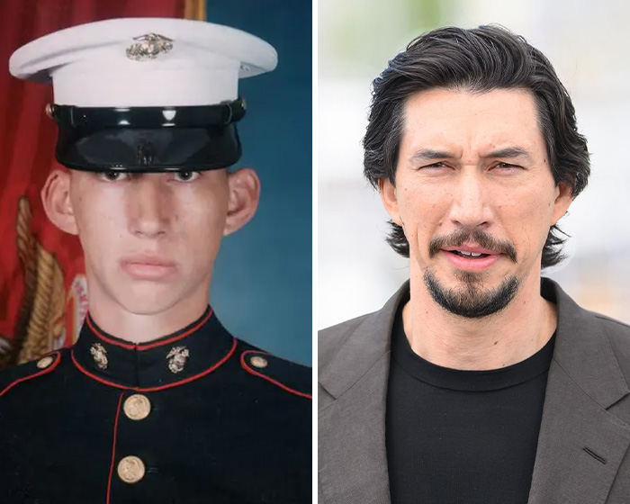 Before and after images of Adam Driver, prompting plastic surgery speculation among netizens.