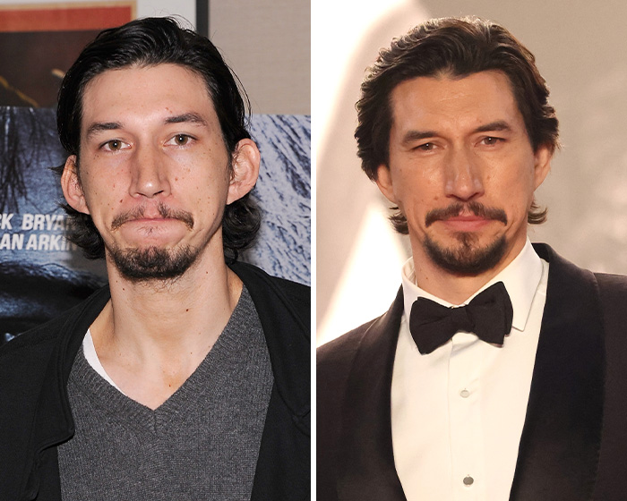 Side-by-side comparison of Adam Driver's photos, raising plastic surgery questions.