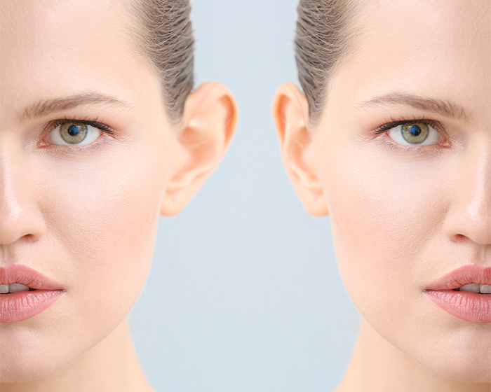 A split image of a woman's face, showcasing plastic surgery speculation with different ear positions.
