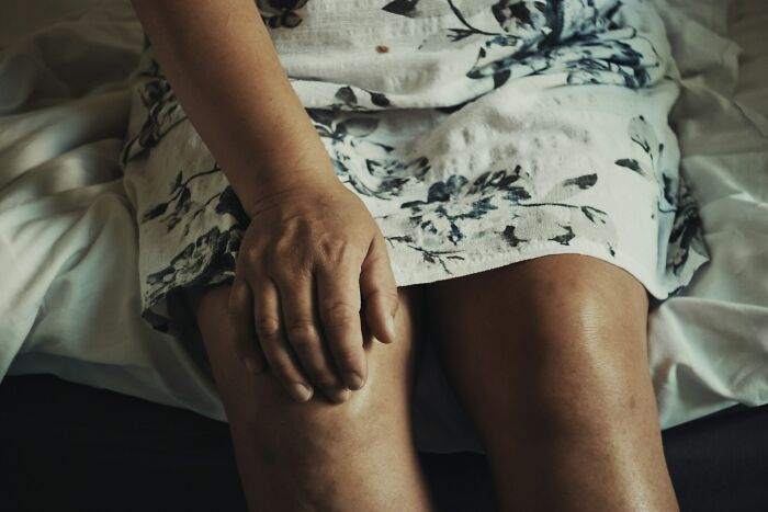 Woman in a floral dress touching her knee. Illustrates discomfort from a pure nightmare airline seating lottery and seatmate.