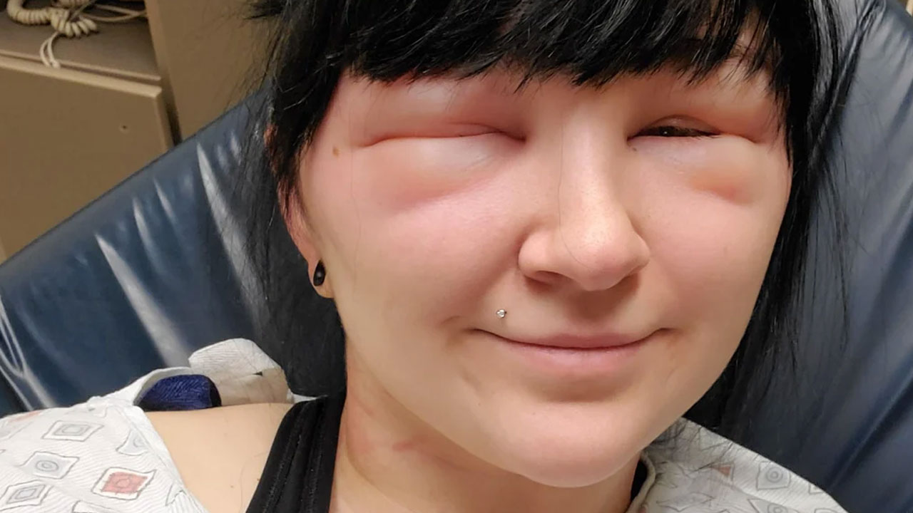 64 People Share The Beauty Procedures They Wish They Could Take Back