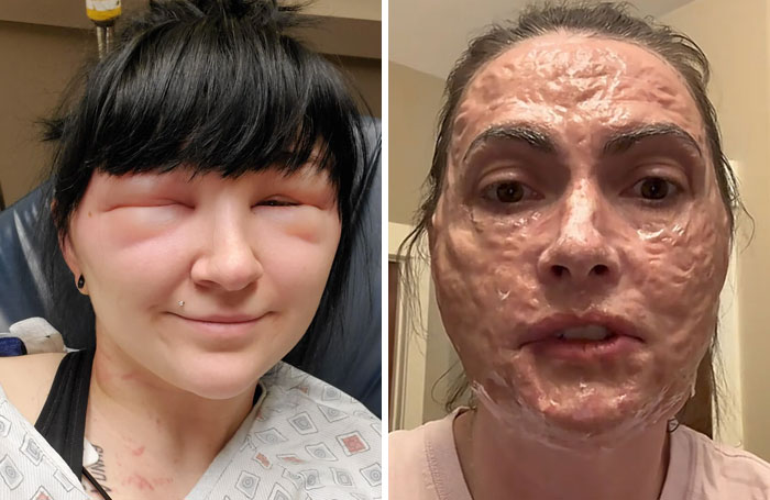 64 Beauty Procedures That Absolutely Missed The Mark And Left People With Regrets
