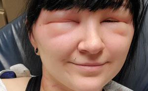 64 People Share The Beauty Procedures They Wish They Could Take Back