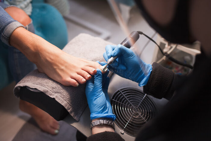 Medical professional treating a foot with a drill, revealing serious issues that started innocently.